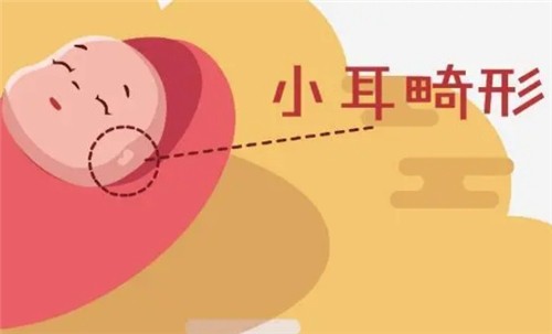 【河南中醫(yī)藥大學一附院】莊洪興教授暑假坐診，耳畸形修復限時預約！