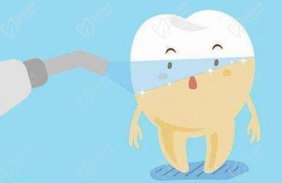viva冷光美白是國產(chǎn)的嗎？