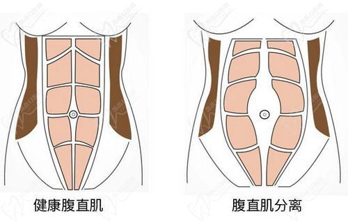 四川現(xiàn)代醫(yī)院李獻和醫(yī)生口碑評價